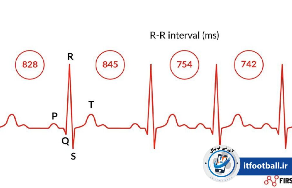 ضربان قلب
آی تی فوتبال